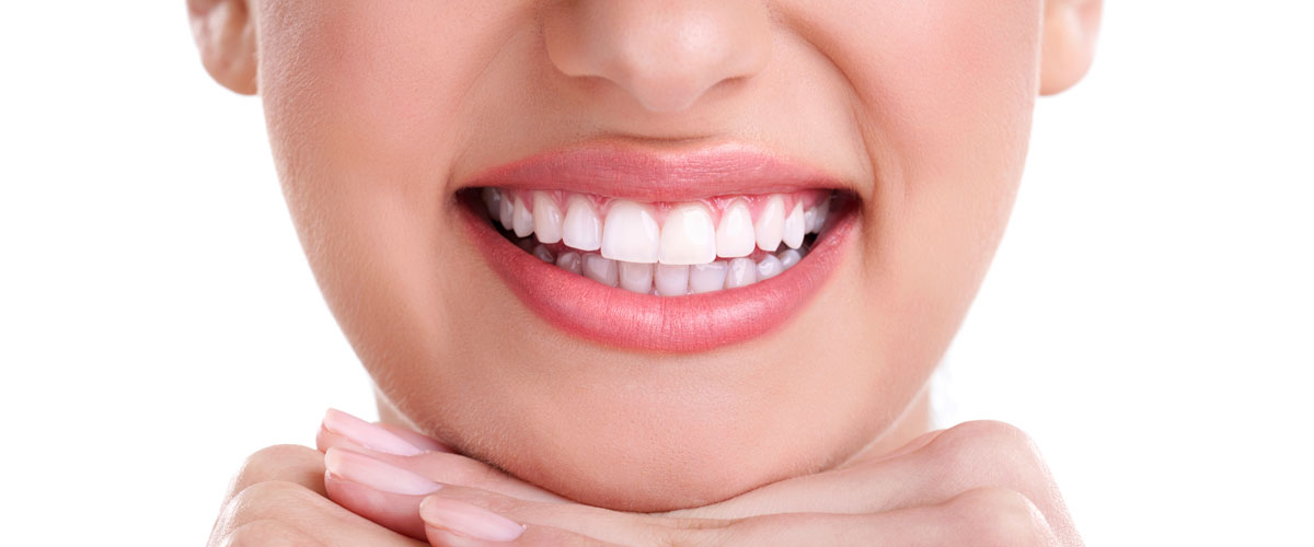 Blanqueamiento dental