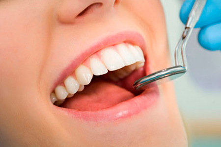 Tratamiento de Periodoncia claravilla tratamientos dentales