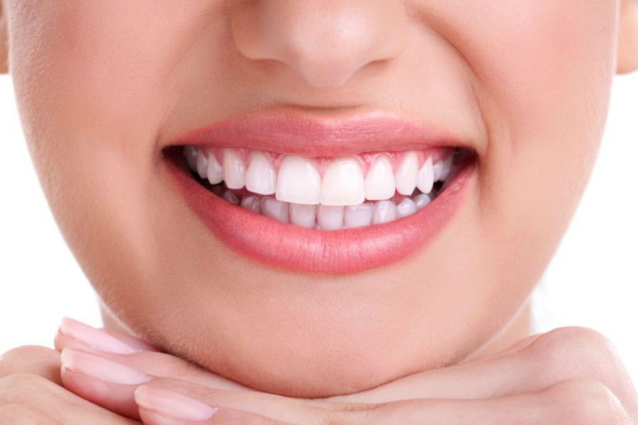 ¿El Blanqueamiento dental es malo para los dientes?