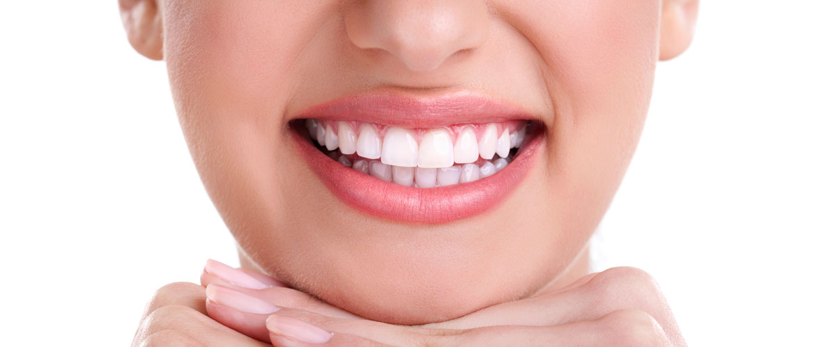 ¿El Blanqueamiento dental es malo para los dientes?